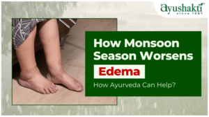 How Monsoon Season Worsens Edema and How Ayurveda Can Help?