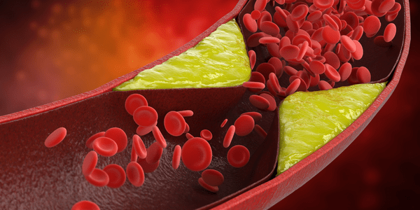 Is it possible to live with High Cholesterol (dyslipidemia)? What makes cholesterol so essential?