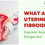 What are Uterine Fibroids?